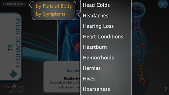SpineEffects(圖5)-速報App