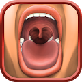 Tonsil Stones Removal Apk