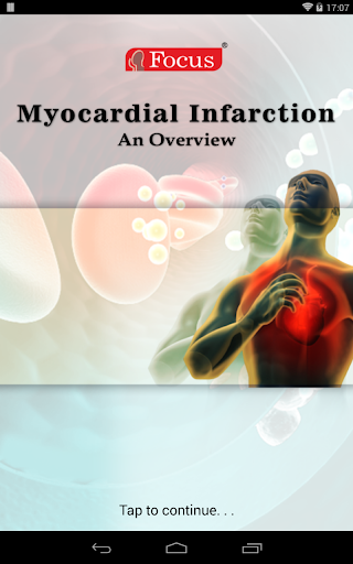 Myocardial infarction