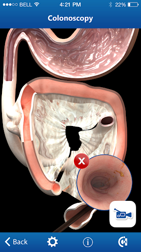 Endoscopy in Dogs Free