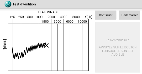  Test d'Audition – Vignette de la capture d'écran  
