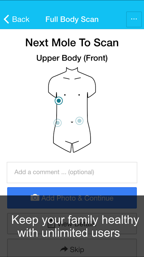   Skin Cancer App - MySkinPal- screenshot  