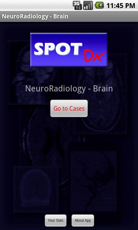 Android application NeuroRadiology - Brain screenshort