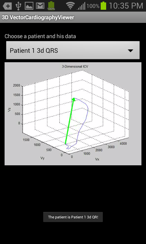 Android application Cardiography Viewer 3D screenshort