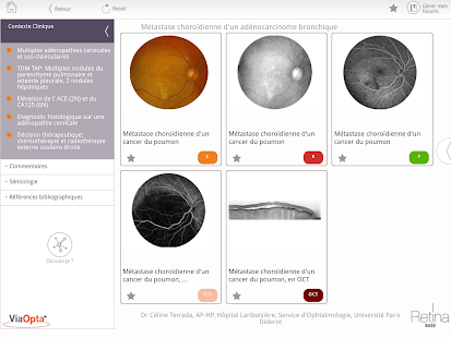 Retina Base Screen 2