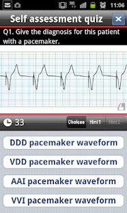 easy ECG training(圖2)-速報App