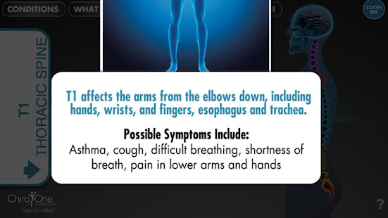 SpineEffects(圖4)-速報App