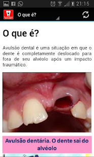 How to install Avulsão Dental: O que fazer? patch 1.0 apk for laptop