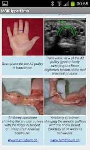 How to get MSK ultrasound Upper Limb lastet apk for bluestacks