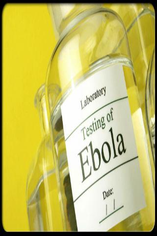 Ebola Virus Symptoms