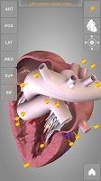 Heart 3D Anatomy APK تصویر نماگرفت #10