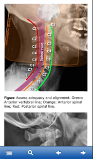 Advanced Trauma Life Support(圖2)-速報App