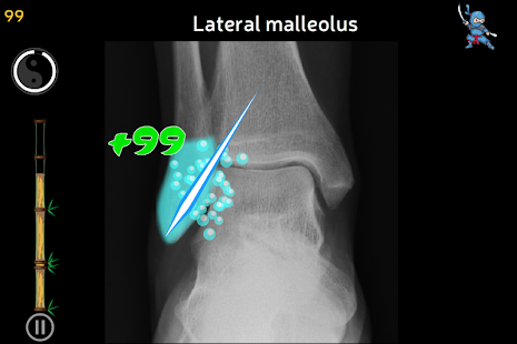 Anatomy Ninja Lower Limb(圖4)-速報App