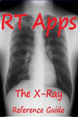 X-Ray Formulas