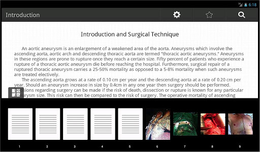 【免費醫療App】Aortic Surgery-APP點子