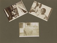 Leprozenkolonie Danaradja: patiënten