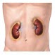 Urology Diseases