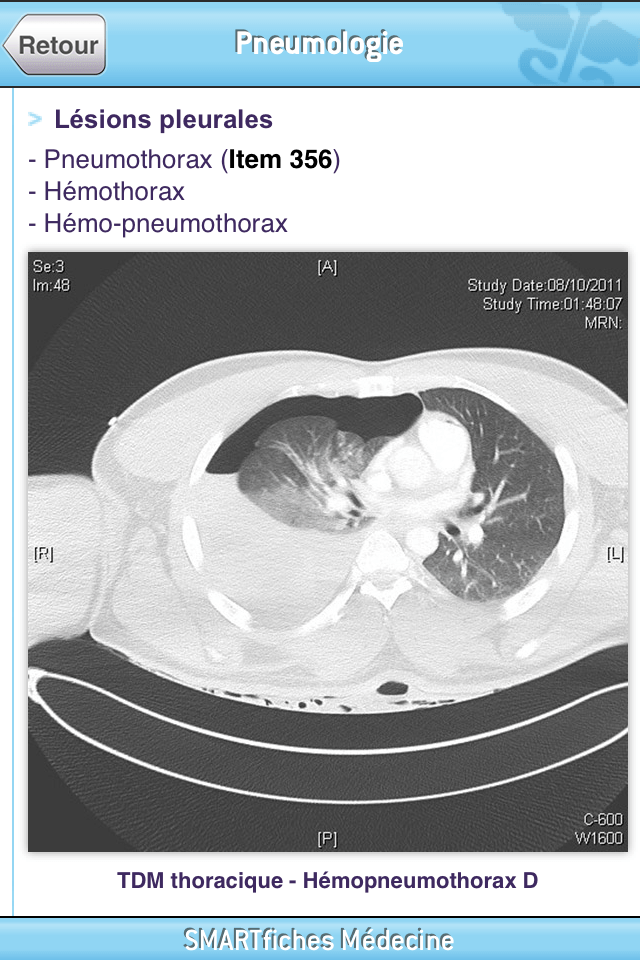 SMARTfiches Pneumologie Free Screen 3