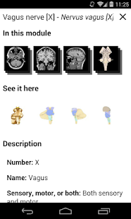 e-Anatomy(圖6)-速報App
