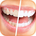 How to whiten your teeth Apk