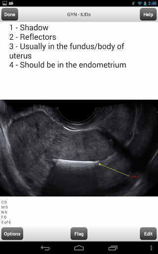 免費下載教育APP|ARDMS Ultrasound Flashcards Lt app開箱文|APP開箱王