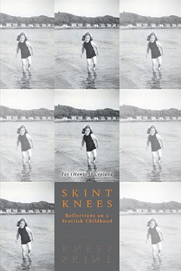 Skint Knees cover