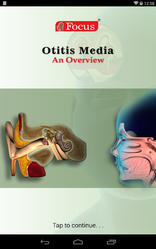 Otitis media