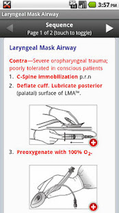 EMS BLS Guide(圖3)-速報App