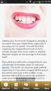 Free Download Repairing The Front Tooth APK for PC