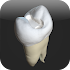 CavSim : Dental Cavity Trial1.0