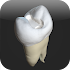 CavSim : Dental Cavity Trial1.0