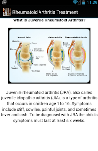 Rheumatoid Arthritis Treatment Screenshots 4