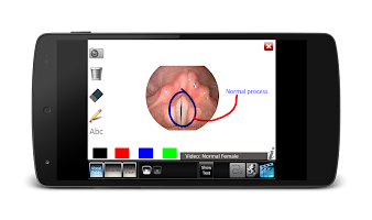 Vocal Folds ID APK צילום מסך #5