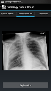 Radiology Cases: Chest(圖2)-速報App