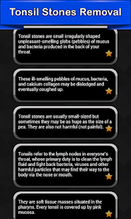 Tonsil Stones Removal(圖2)-速報App