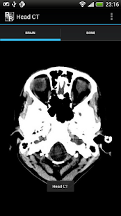 RadRevision: Anatomy on CT(圖2)-速報App