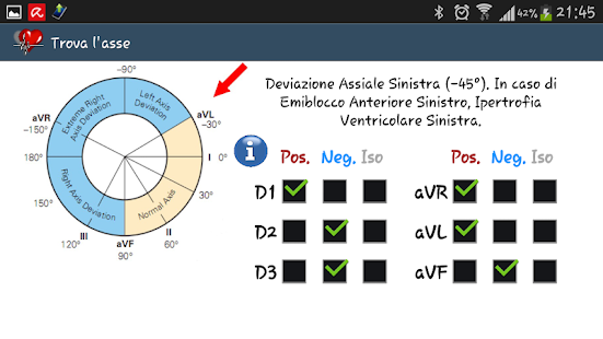 ECG pratico