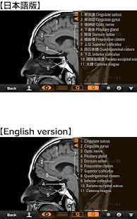 Interactive CT and MRI Anatomy(圖3)-速報App