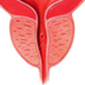 Prostate Cancer Calculator 1.0.4