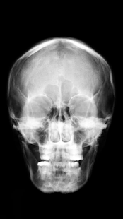 X-ray Body Scanner Prank Screenshots 1