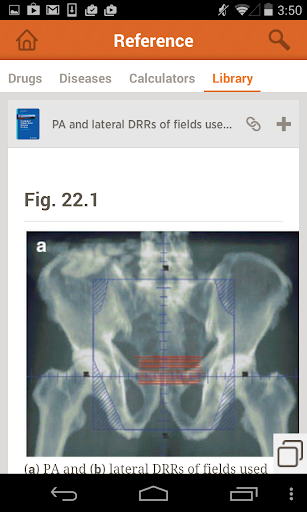 【免費醫療App】Handbook of Radiation Oncology-APP點子