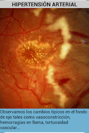 ophthalmology poster 9
