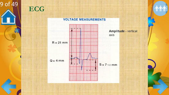 Basic ECG Interpretation Screenshots 3