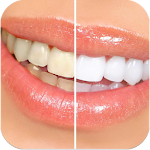 Cover Image of Download وصفات لتبييض الاسنان 1.0 APK