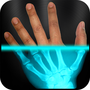Xray Scanner Prank Hacks and cheats