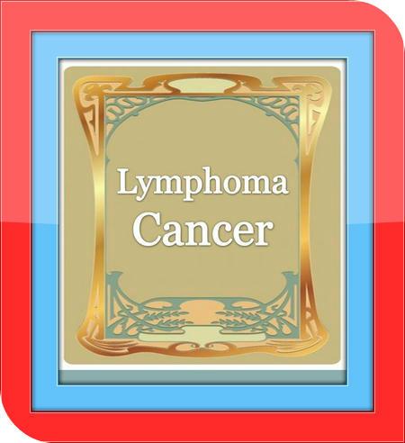 Lymphoma Cancer - Guide