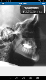  IMS Mobile: miniatuur van screenshot  