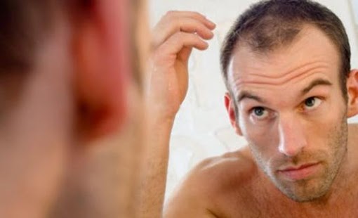 Download Hair Fall Men APK for Android