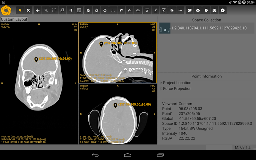 【免費醫療App】Symmetry DICOM-APP點子