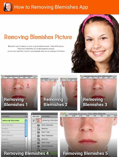 【免費攝影App】Removing Blemishes Image-APP點子